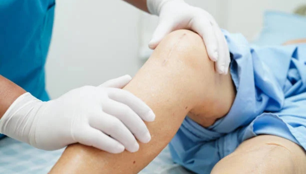 Orthopaedic specialist examining digital knee joint x-ray for surgical alignment planning