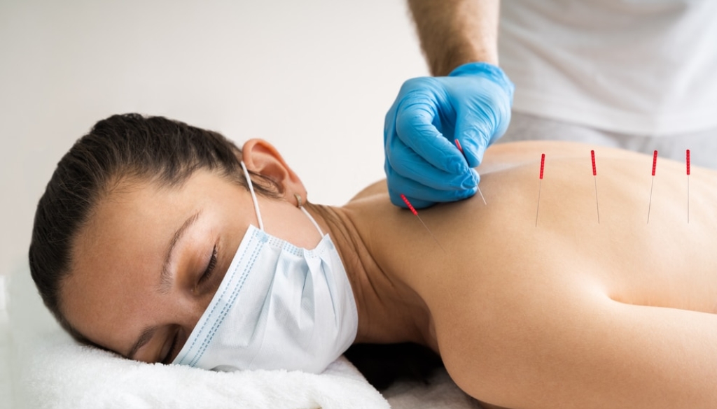 Physiotherapist performing dry needling treatment on a patient's lower back