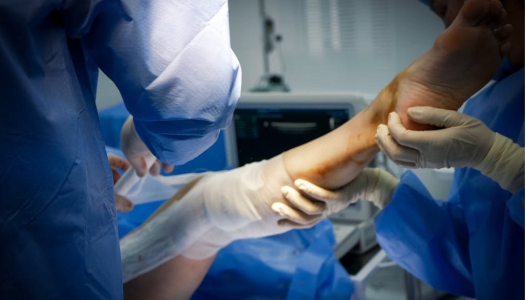 Medical specialist wearing sterile gloves examining and dressing a localized patient foot wound