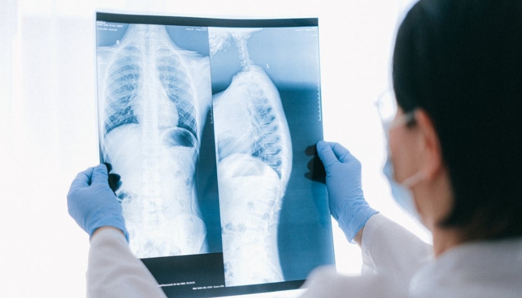 Physiotherapist demonstrating spinal column alignment to a patient during an orthopedic consultation