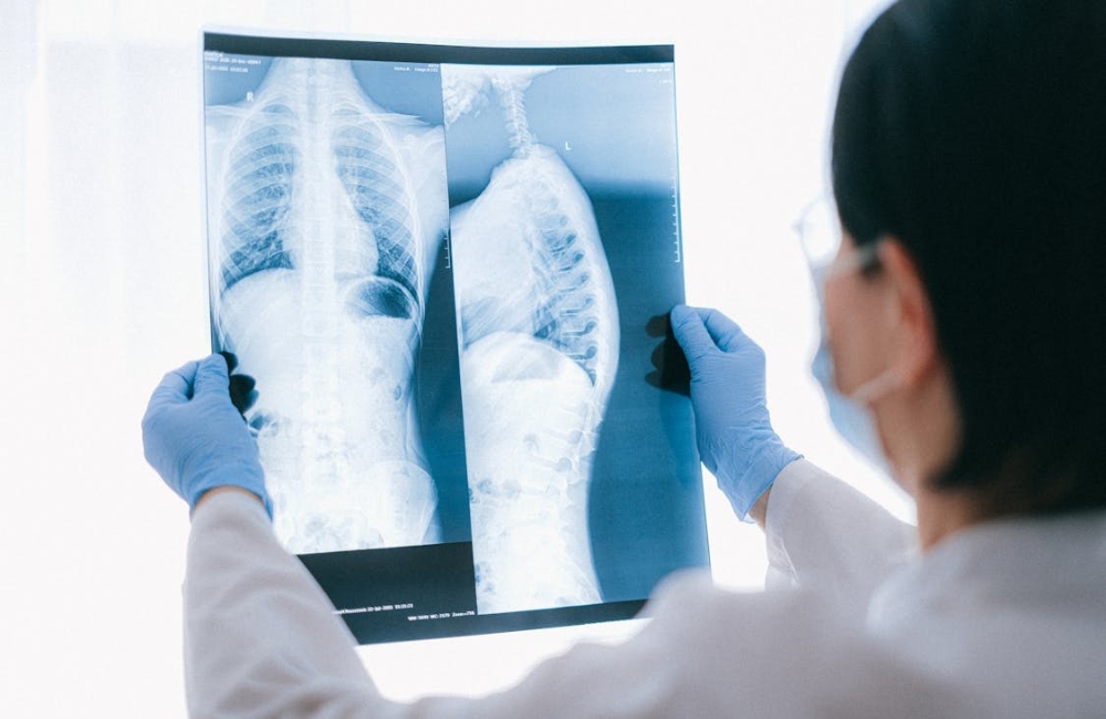 High-contrast medical X-ray scan highlighting the alignment of a human lumbar and thoracic spine